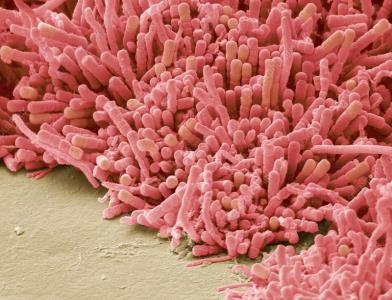بزرگنمایی بیوفیلم باکتریایی پلاک دندان :۸۰۰۰ برابر